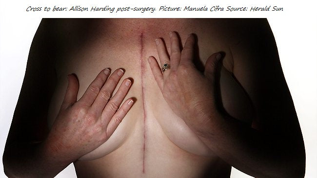 Would you have this surgery?